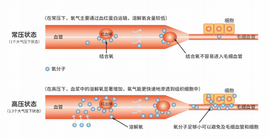 微压氧舱吸氧和普通吸氧有什么不同？